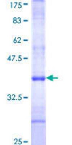 Novus Biologicals Recombinant Human CD77 Synthase GST (N-Term) Protein 10 &mu;g | Buy Online | Novus Biologicals&trade; | Fisher Scientific