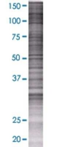 Novus Biologicals WDR9 293T Cell Transient Overexpression Lysate 0.1 mL | Buy Online | Novus Biologicals&trade; | Fisher Scientific