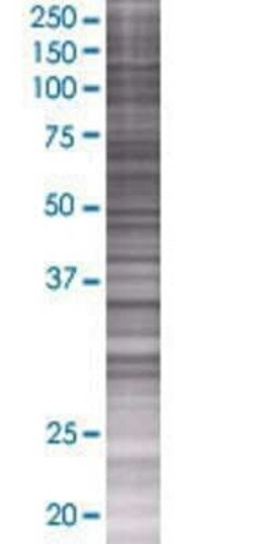 Novus Biologicals PCBP3 293T Cell Transient Overexpression Lysate 0.1 mL | Buy Online | Novus Biologicals&trade; | Fisher Scientific