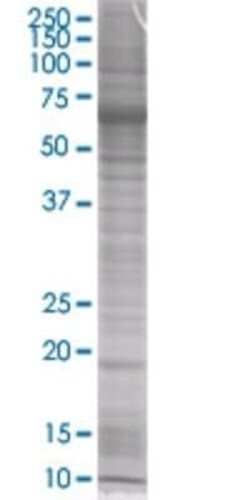 Novus Biologicals DNA Polymerase epsilon subunit 3 293T Cell Transient Overexpression Lysate 0.1 mL | Buy Online | Novus Biologicals&trade; | Fisher Scientific