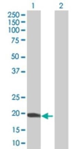 Novus Biologicals DNA Polymerase epsilon subunit 3 293T Cell Transient Overexpression Lysate 0.1 mL | Buy Online | Novus Biologicals&trade; | Fisher Scientific
