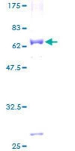 Novus Biologicals Recombinant Human MRPL39 GST (N-Term) Protein 2 &mu;g | Buy Online | Novus Biologicals&trade; | Fisher Scientific