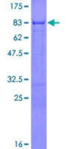 Novus Biologicals Recombinant Human ERRFI1 GST (N-Term) Protein 10 &mu;g | Buy Online | Novus Biologicals&trade; | Fisher Scientific