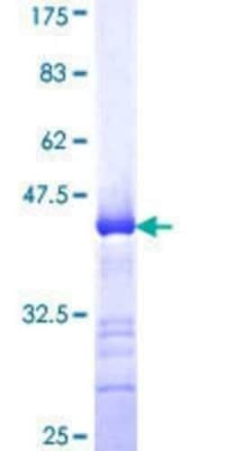 Novus Biologicals Recombinant Human KCNK10 GST (N-Term) Protein 10 &mu;g | Buy Online | Novus Biologicals&trade; | Fisher Scientific