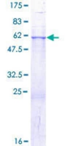 Novus Biologicals Recombinant Human GDAP1 GST (N-Term) Protein 10 &mu;g | Buy Online | Novus Biologicals&trade; | Fisher Scientific