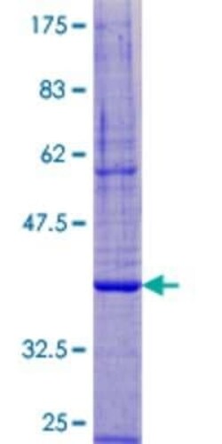 Novus Biologicals Recombinant Human DPM3 GST (N-Term) Protein 10 &mu;g | Buy Online | Novus Biologicals&trade; | Fisher Scientific