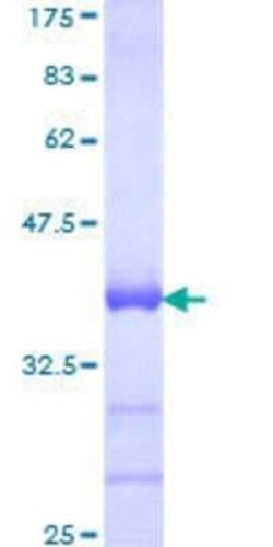 Novus Biologicals Recombinant Human SOX18 GST (N-Term) Protein 25 &mu;g | Buy Online | Novus Biologicals&trade; | Fisher Scientific