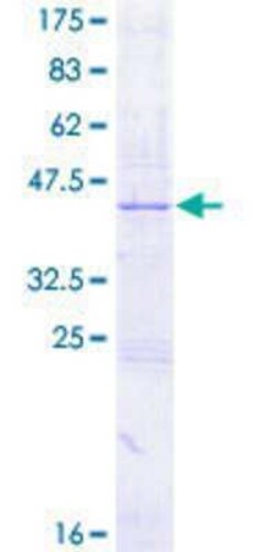 Novus Biologicals Recombinant Human CYTL1 GST (N-Term) Protein 2 &mu;g | Buy Online | Novus Biologicals&trade; | Fisher Scientific