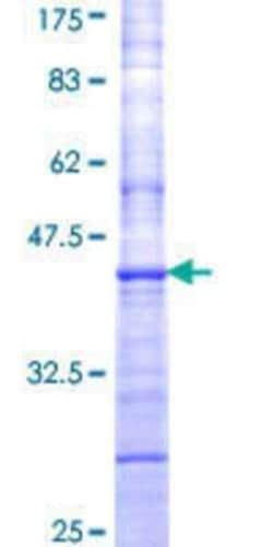 Novus Biologicals Recombinant Human CYTL1 GST (N-Term) Protein 10 &mu;g | Buy Online | Novus Biologicals&trade; | Fisher Scientific