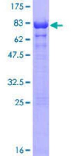 Novus Biologicals Recombinant Human TERF2IP GST (N-Term) Protein 10 &mu;g | Buy Online | Novus Biologicals&trade; | Fisher Scientific