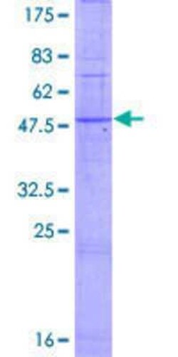 Novus Biologicals Recombinant Human TAS2R5 GST (N-Term) Protein 2 &mu;g | Buy Online | Novus Biologicals&trade; | Fisher Scientific