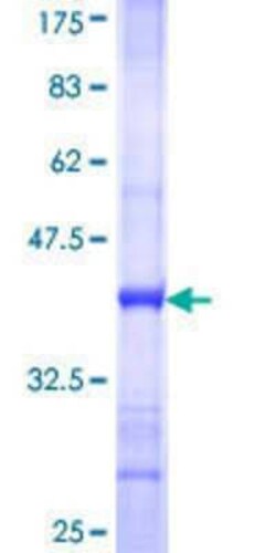 Novus Biologicals Recombinant Human DNAJC10 GST (N-Term) Protein 25 &mu;g | Buy Online | Novus Biologicals&trade; | Fisher Scientific