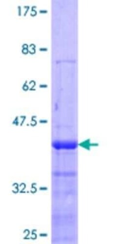 Novus Biologicals Recombinant Human SSH1 GST (N-Term) Protein 10 &mu;g | Buy Online | Novus Biologicals&trade; | Fisher Scientific