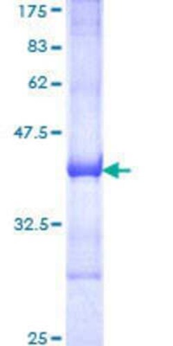 Novus Biologicals Recombinant Human RIN2 GST (N-Term) Protein 25 &mu;g | Buy Online | Novus Biologicals&trade; | Fisher Scientific
