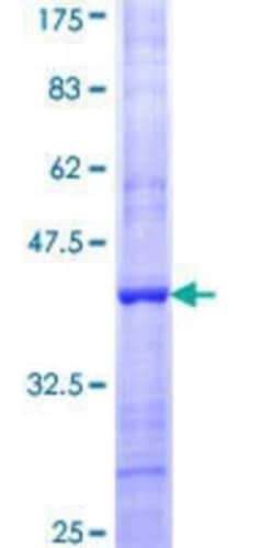 Novus Biologicals Recombinant Human FBXO42 GST (N-Term) Protein 10 &mu;g | Buy Online | Novus Biologicals&trade; | Fisher Scientific