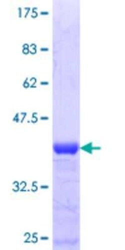 Novus Biologicals Recombinant Human TAF7L GST (N-Term) Protein 10 &mu;g | Buy Online | Novus Biologicals&trade; | Fisher Scientific