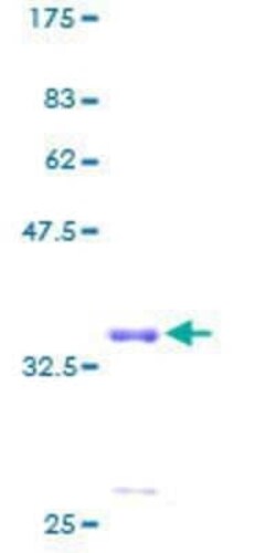 Novus Biologicals Recombinant Human MRPS21 GST (N-Term) Protein 2 &mu;g | Buy Online | Novus Biologicals&trade; | Fisher Scientific