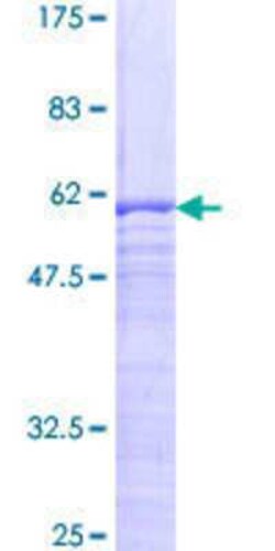 Novus Biologicals Recombinant Human SPIN2A GST (N-Term) Protein 25 &mu;g | Buy Online | Novus Biologicals&trade; | Fisher Scientific