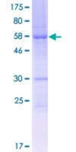 Novus Biologicals Recombinant Human FAM64A GST (N-Term) Protein 25 &mu;g | Buy Online | Novus Biologicals&trade; | Fisher Scientific