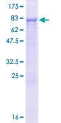 Novus Biologicals Recombinant Human CCDC76 GST (N-Term) Protein 10 &mu;g | Buy Online | Novus Biologicals&trade; | Fisher Scientific