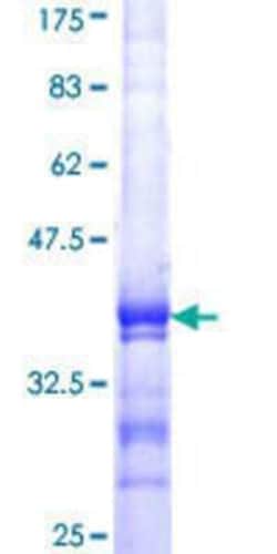 Novus Biologicals Recombinant Human DGCR8 GST (N-Term) Protein 25 &mu;g | Buy Online | Novus Biologicals&trade; | Fisher Scientific