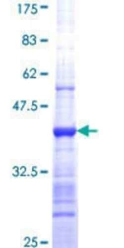 Novus Biologicals Recombinant Human PRMT7 GST (N-Term) Protein 10 &mu;g | Buy Online | Novus Biologicals&trade; | Fisher Scientific
