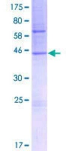 Novus Biologicals Recombinant Human TMCO1 GST (N-Term) Protein 2 &mu;g | Buy Online | Novus Biologicals&trade; | Fisher Scientific