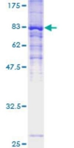 Novus Biologicals Recombinant Human ZDHHC13 GST (N-Term) Protein 10 &mu;g | Buy Online | Novus Biologicals&trade; | Fisher Scientific