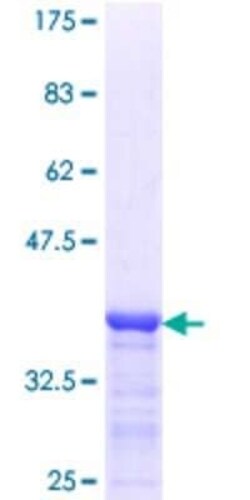 Novus Biologicals Recombinant Human VASA GST (N-Term) Protein 10 &mu;g | Buy Online | Novus Biologicals&trade; | Fisher Scientific
