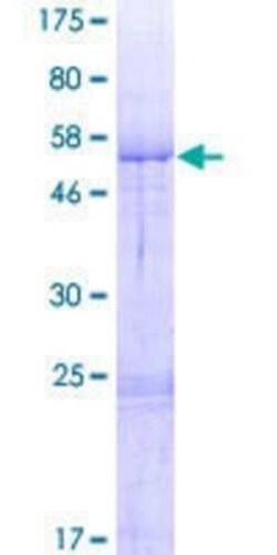 Novus Biologicals Recombinant Human MTRF1L GST (N-Term) Protein 2 &mu;g | Buy Online | Novus Biologicals&trade; | Fisher Scientific