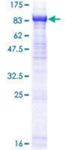 Novus Biologicals Recombinant Human ASNSD1 GST (N-Term) Protein 25 &mu;g | Buy Online | Novus Biologicals&trade; | Fisher Scientific