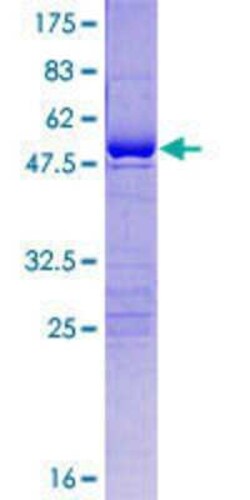 Novus Biologicals Recombinant Human USP53 GST (N-Term) Protein 10 &mu;g | Buy Online | Novus Biologicals&trade; | Fisher Scientific