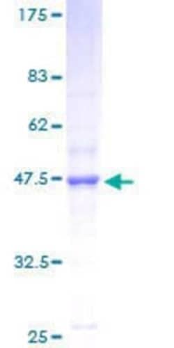 Novus Biologicals Recombinant Human NDUFB11 GST (N-Term) Protein 10 &mu;g | Buy Online | Novus Biologicals&trade; | Fisher Scientific