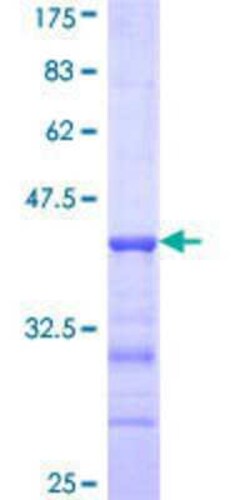 Novus Biologicals™ Recombinant Human MNAB GST (N-Term) Protein