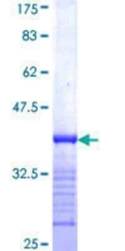 Novus Biologicals Recombinant Human MTMR12 GST (N-Term) Protein 25 &mu;g | Buy Online | Novus Biologicals&trade; | Fisher Scientific