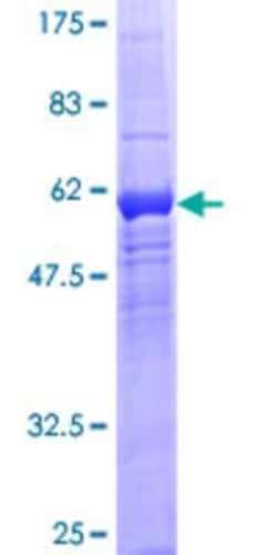 Novus Biologicals Recombinant Human WDR5B GST (N-Term) Protein 25 &mu;g | Buy Online | Novus Biologicals&trade; | Fisher Scientific