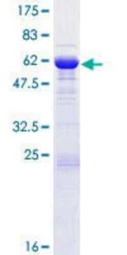 Novus Biologicals Recombinant Human SGTB GST (N-Term) Protein 10 &mu;g | Buy Online | Novus Biologicals&trade; | Fisher Scientific