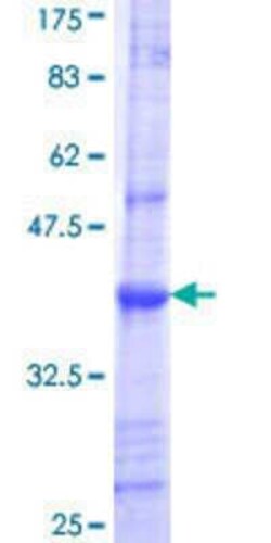 Novus Biologicals Recombinant Human UGT1A10 GST (N-Term) Protein 25 &mu;g | Buy Online | Novus Biologicals&trade; | Fisher Scientific