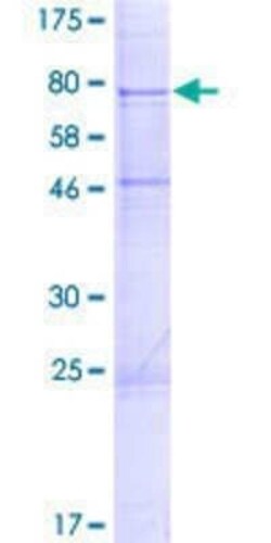 Novus Biologicals Recombinant Human UGT1A6 GST (N-Term) Protein 2 &mu;g | Buy Online | Novus Biologicals&trade; | Fisher Scientific