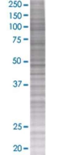 Novus Biologicals SCAND2 293T Cell Transient Overexpression Lysate 0.1 mL | Buy Online | Novus Biologicals&trade; | Fisher Scientific