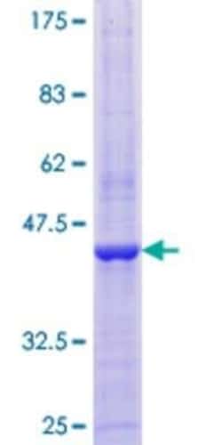 Novus Biologicals Recombinant Human EGLN1/PHD2 GST (N-Term) Protein 10 &mu;g | Buy Online | Novus Biologicals&trade; | Fisher Scientific