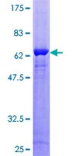 Novus Biologicals Recombinant Human GNB1L GST (N-Term) Protein 10 &mu;g | Buy Online | Novus Biologicals&trade; | Fisher Scientific