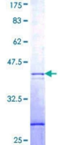 Novus Biologicals Recombinant Human GNB1L GST (N-Term) Protein 10 &mu;g | Buy Online | Novus Biologicals&trade; | Fisher Scientific