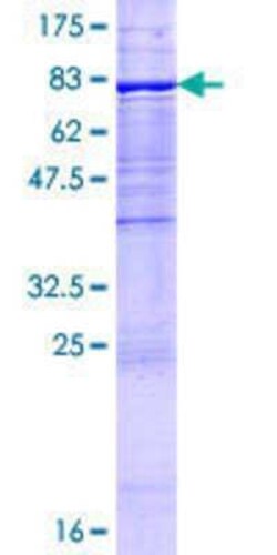 Novus Biologicals Recombinant Human UGT1A9 GST (N-Term) Protein 2 &mu;g | Buy Online | Novus Biologicals&trade; | Fisher Scientific