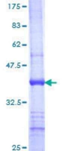 Novus Biologicals Recombinant Human UGT1A9 GST (N-Term) Protein 10 &mu;g | Buy Online | Novus Biologicals&trade; | Fisher Scientific