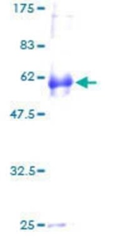 Novus Biologicals Recombinant Human NDFIP2 GST (N-Term) Protein 10 &mu;g | Buy Online | Novus Biologicals&trade; | Fisher Scientific