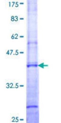 Novus Biologicals Recombinant Human UGT1A4 GST (N-Term) Protein 25 &mu;g | Buy Online | Novus Biologicals&trade; | Fisher Scientific