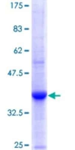 Novus Biologicals Recombinant Human UGT1A3 GST (N-Term) Protein 10 &mu;g | Buy Online | Novus Biologicals&trade; | Fisher Scientific