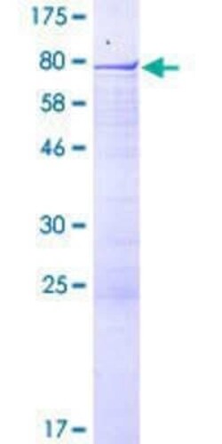 Novus Biologicals Recombinant Human RSBN1 GST (N-Term) Protein 2 &mu;g | Buy Online | Novus Biologicals&trade; | Fisher Scientific