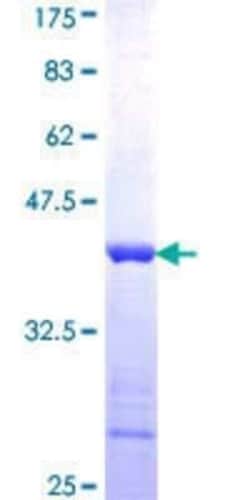 Novus Biologicals Recombinant Human GTPBP2 GST (N-Term) Protein 10 &mu;g | Buy Online | Novus Biologicals&trade; | Fisher Scientific